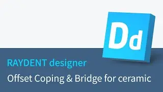 RAYDENT designer workflow - Offset Coping & Bridge for ceramic