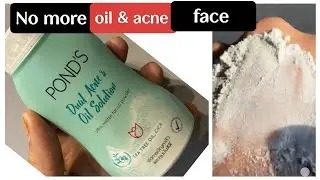 ponds dual acne and oil solution powder review #pondspowder