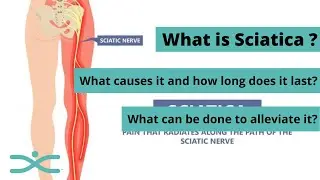 Can Chiropractic Help Sciatica?