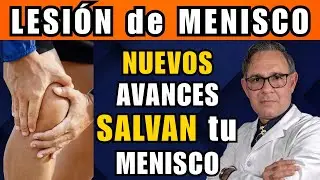 Rotura de MENISCO – Nuevos AVANCES en CIRUGÍA y REHABILITACIÓN.