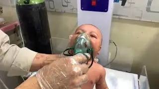 Cutest Baby in NICU – Bronchiolitis Nebulization Time 💙 #NICU #Bronchiolitis
