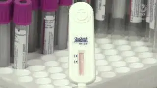 Prueba oral para detección de VIH