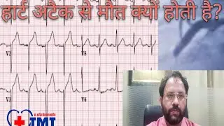 Why Heart attack is such a dangerous disease ? #Heartattack #DrTarikMdTasleem