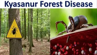 Kyasanur Forest Disease: Don't Get Ticked | Tick-Borne Viral Disease | KFD