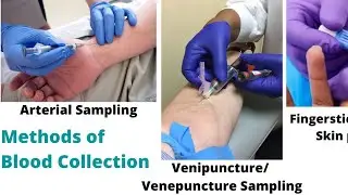 Blood Collection methods|| Types of Blood Collection || Arterial blood Collection ||.Vein Blood Coll