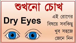 Dry Eyes treatment in Bengali #doctorSight #dryEyes #dryEyesTreatment #dryEyesPrevention