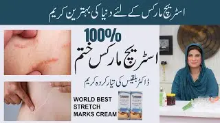 STRETCH MARKS REMOVER | ANTI STRETCH MARKS CREAM | BY DR. BILQUIS SHAIKH