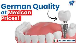 Dental Implants in San Jose del Cabo (For Restorative Dentistry in Mexico)