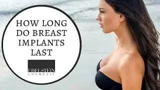 How Long Do Breast Implants Last | Edelstein Cosmetic