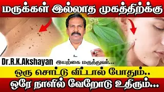 ஒரே நாள்! ஒரே மூலிகை! மருக்களை வேரோடு போக்கும் அற்புத மூலிகை | Dr.RK Akshayan