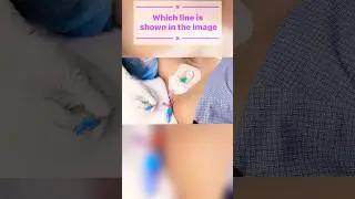 Can You Guess the Shown Line? Comment and Find Out! 🔥 #Procedure #viral #kirtiprosperclasses #cvp