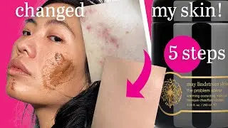 MAY LINDSTROM Skincare Acne Problem Solver | Testing ChatGPT 🤖