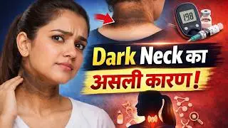 Acanthosis Nigricans क्या है? 😳 Dark Neck & Body Folds का Real Reason | Causes, Types & Treatment 🔬