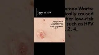 Types of HPV