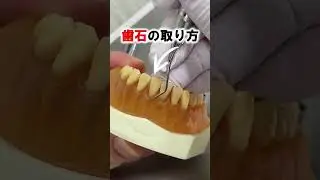 歯石を取る器具【スケーラー】 #Shorts