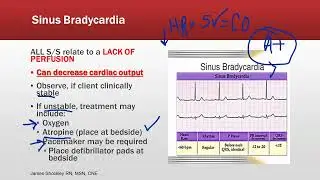 2025 Sinus Rhythms