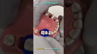 Quick Dam Tutorial | How to Attach #dental #dentalclinic #dentalinnovation #trending #2025