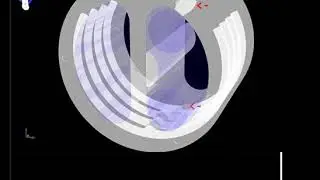 Lung Motion Phantom X-Ray Image Simulation