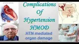 🔴 1- Complications of Hypertension (HMOD), Dr.Hazem Sayed