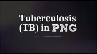 School resources | Tuberculosis in Papua New Guinea