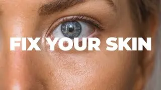 Eliminate Skin Issues: Scientific Solutions for Eczema, Psoriasis & Acne