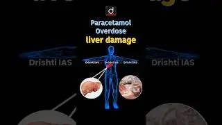 Dolo-650 | Paracetamol Overdose | Drishti IAS English | #shorts | #DrishtiIASEnglish