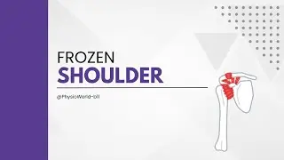 Frozen shoulder🦾 | Treatment of frozen shoulder✅ | Causes and symptoms☝🏻