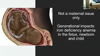 MCHRI Seminar Series: Iron Deficiency Anemia in Pregnancy