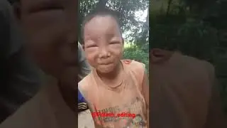 Borole kamurile kela🤣||see a small Assamese kid bitten by a bee🤣 funny moment