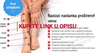 Varikosette Krema
