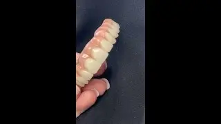 All-on-Four Reveal  Titanium Bar  Zirconia Teeth #shorts