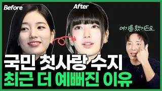 [sub] Conjunctival Nevus: Suzy, IU & Irene&rsquo;s Eye Spot &ndash; What It Is & How to Remove It