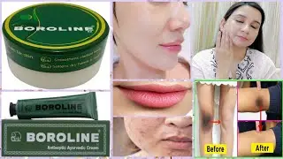 Top 10 uses of BOROLINE for skincare ll 100% Result ll Amazing Benefits of BOROLINE l BOROLINE hacks