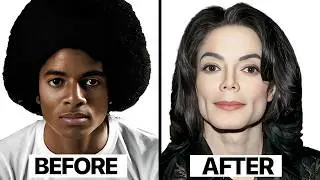 Michael Jackson Plastic Surgery Before and After photos(1958 - 2009)