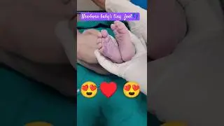 Newborn baby&rsquo;s foot#tiny foot#normal vaginal delivery#shorts#