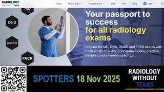 100-Second Radiology Spotters Challenge | 18 Nov 2025   | RWT Radiology