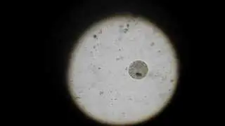 Parasitic ciliate Ichthyophthirius multifiliis| Паразитическая инфузория ихтиофтириус