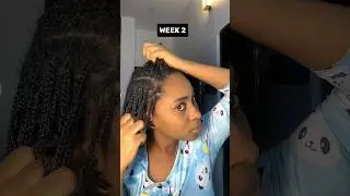 This grew my hair fast!!!!! Mini braids for hair growth 2024 #minibraids #naturalhair