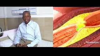 Heart Attack Survivor Speaks Out: The Luckiest Nigerian Alive | A Story of Hope & Recovery