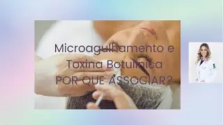 Microagulhamento X Toxina botulínica