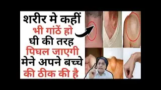 शरीर में गांठ का पक्का इलाज। Sujok Therapy For Cyst In Body। Acupressure Points For Cyst