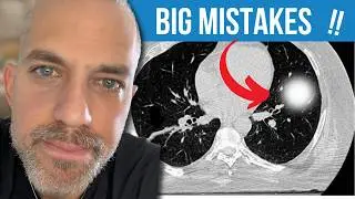 How Cancer Patients Should Read CT Scans EVERYTIME to Beat Cancer!