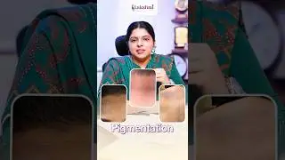 Hair Dye & Pigmentation | Dermatologist Explains Safe Hair Dye Use | Pigmentation Causes & Solutions