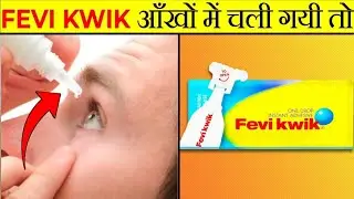 FeviKwik आंखों में चला जाए तो? | What If FaviKwik Goes Inside The Eyes? | Most Amazing Facts |