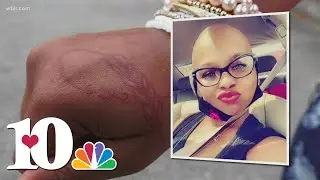 Breast cancer survivor encourages women not to keep the diagnosis a secret