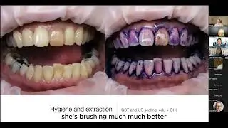 Larkin Protocol Case Studies - Dr Jason Pang