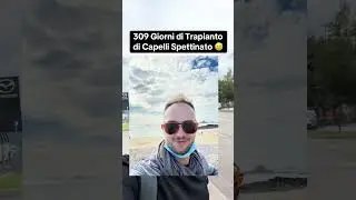 309 Giorni di Trapianto di Capelli Spettinato 😅 #trapianto #trapiantocapelli #alopecia #stempiatura