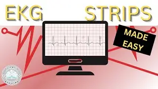 How to Read EKG Strips (Understand EKG Basics) - Scientia Nursing