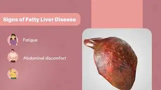 Fatty liver disease