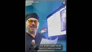 Total Hip Replacement For DDH Case In 59 Years Old Patient